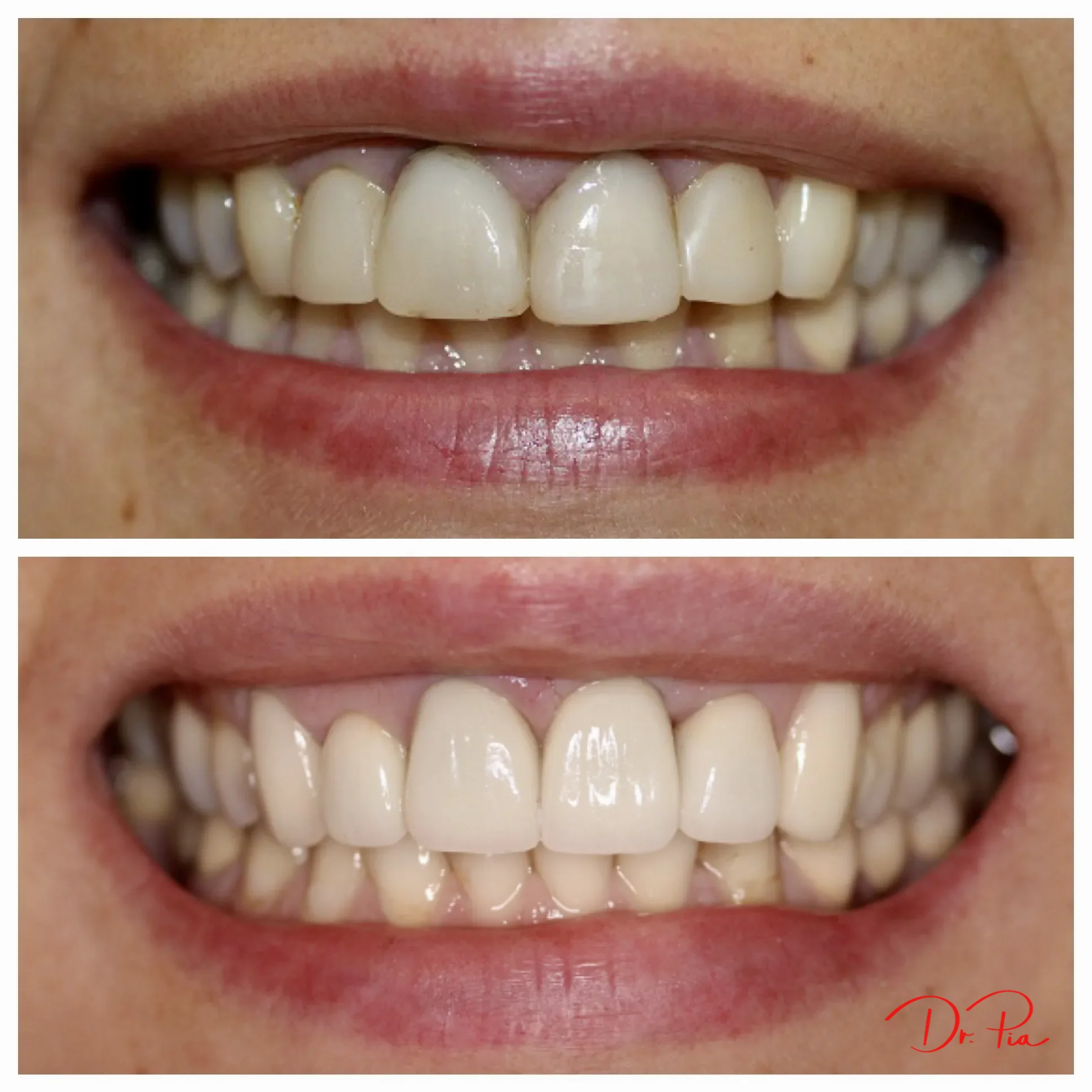 Afraid of the Dentist? Real Strategies for Dental Anxiety