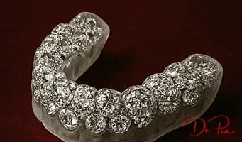 Teeth Grinding: Signs You're Doing It and How to Stop