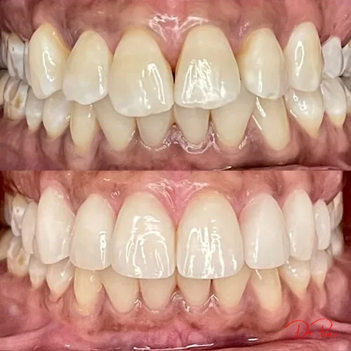 How to Make Your Cosmetic Dental Work Last
